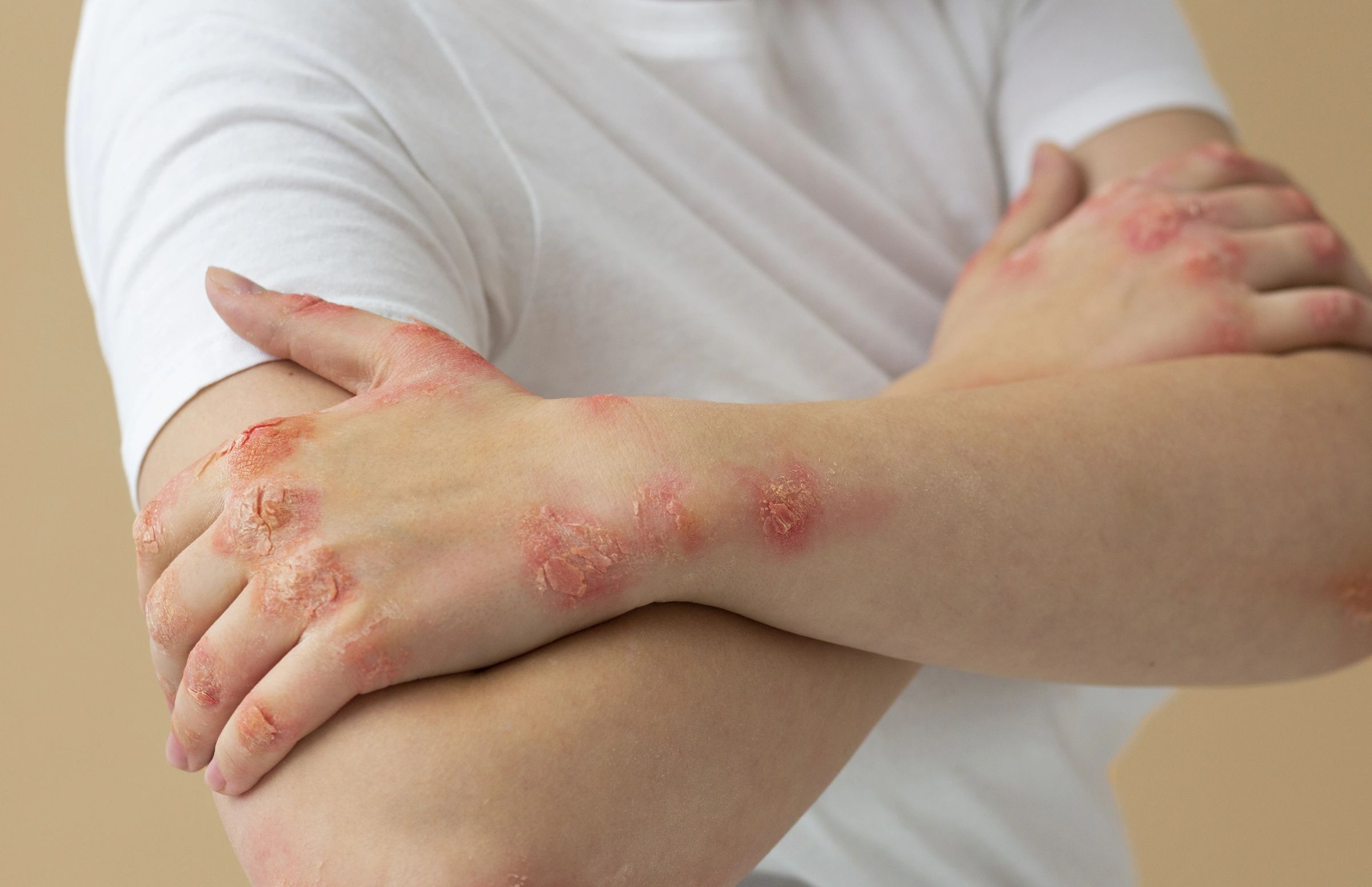 Dấu hiệu nhận biết và nguyên nhân