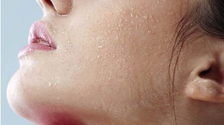 Cách khắc phục da khô bong tróc hiệu quả