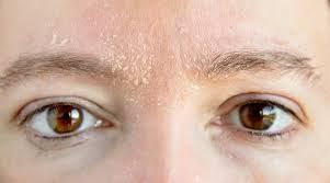 Lời khuyên để duy trì làn da ẩm mịn