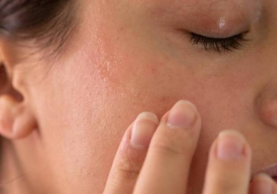 Tác hại khi da khô không được xử lý đúng cách
