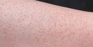Những điều cần tránh tuyệt đối sau khi wax lông