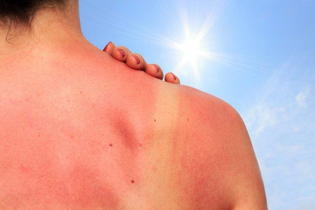 Khi nào bạn cần đến gặp bác sĩ da liễu