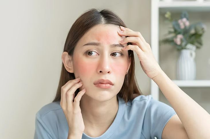 Các thành phần "vàng" giúp phục hồi da sau nắng