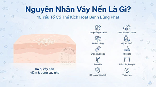 Nguyên Nhân Vảy Nến Là Gì? 10 Yếu Tố Có Thể Kích Hoạt Bệnh Bùng Phát